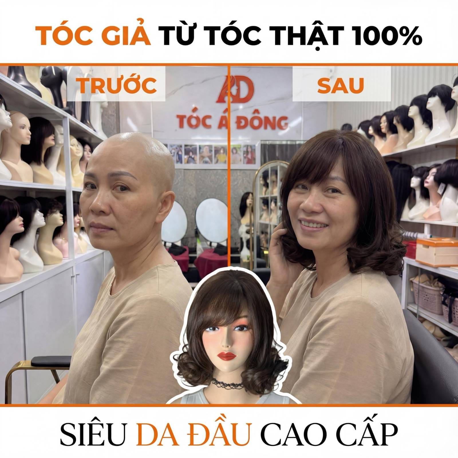 Hình ảnh thực tế khách hàng rụng tóc tìm lại nụ cười và sự tự tin cùng Tóc Á Đông